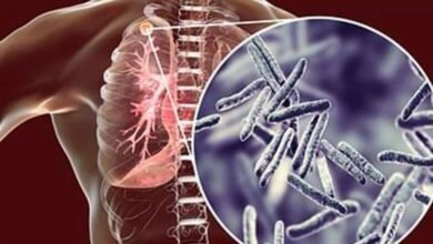 टीबी से मौत रोकने के लिए तमिलनाडु सरकार की नई रणनीति कारगर