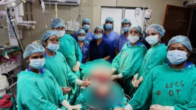 अम्बेडकर अस्पताल में दुर्लभ एवं अपने आप में अनोखी सेकेंडरी एब्डोमिनल प्रेग्नेंसी का सफल ऑपरेशन